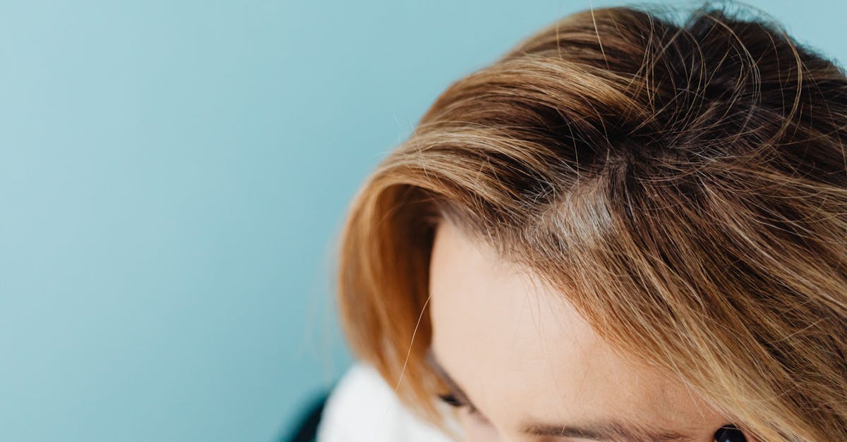 AGA治療の副作用やリスクについて正しく理解することが大切