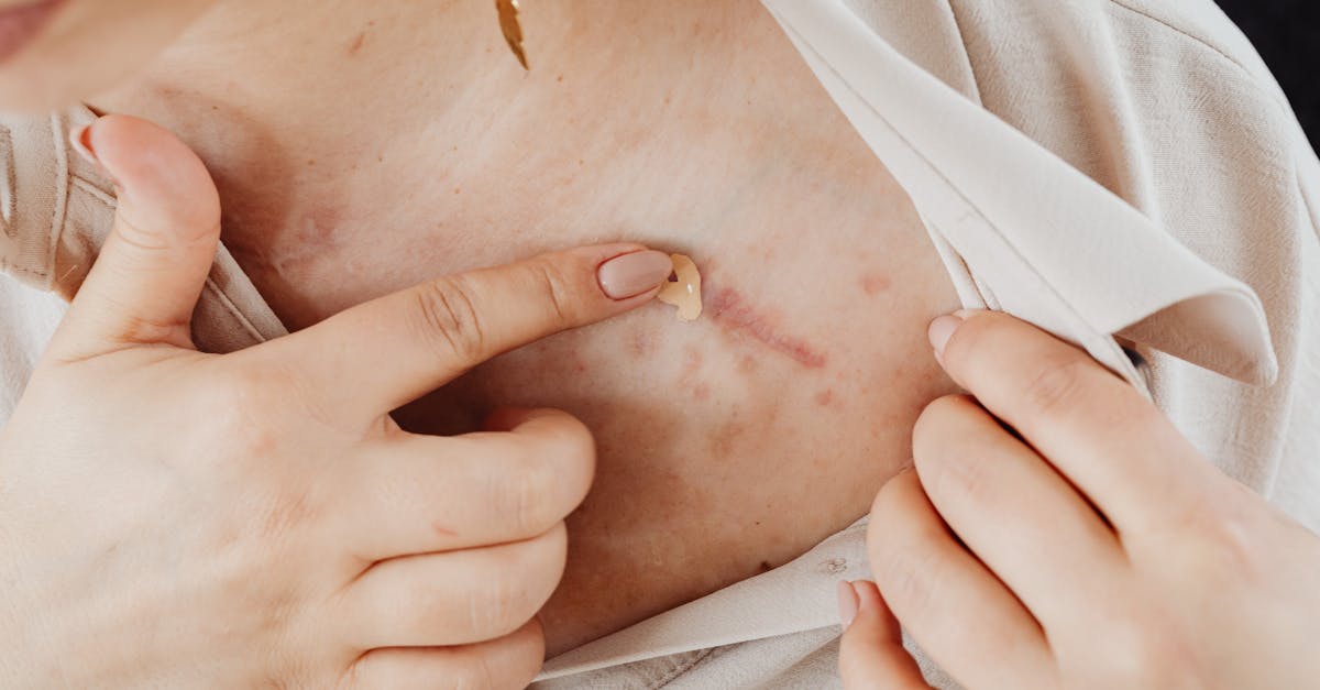 敏感肌の女性がやさしくスキンケアを行う様子。刺激の少ない処方で安心して使える印象を表現。